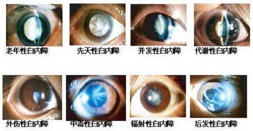 三门峡市眼科医院真人口碑评价怎么样？