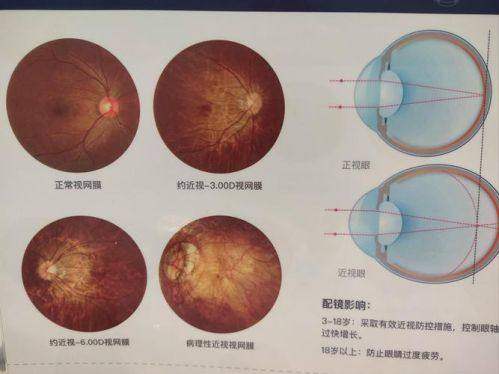 长春市中医院眼科地址电话营业时间