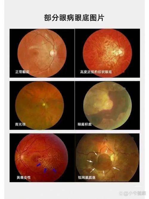 长春市中医院眼科特色项目及技术优势