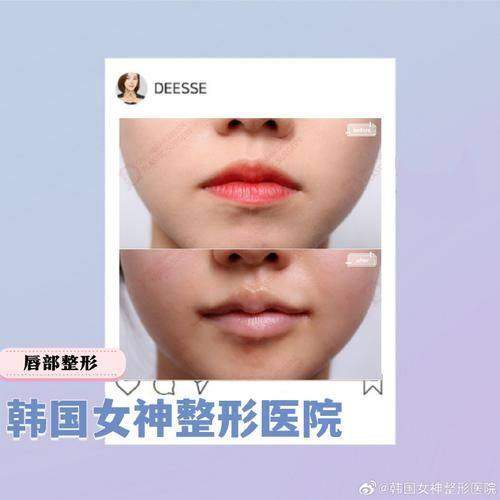 韩国傲婷美整形外科医院详细的预约挂号方式及流程