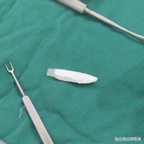 柳州市美嘉医疗美容真人口碑评价怎么样？