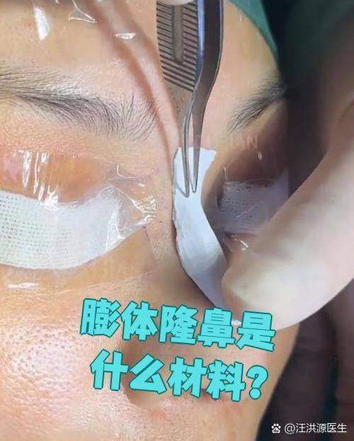 长沙伊百丽医疗美容医院收费价格表/收费标准